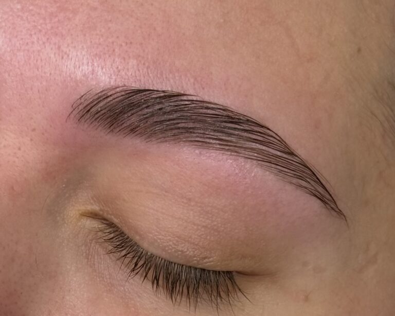 Browlift